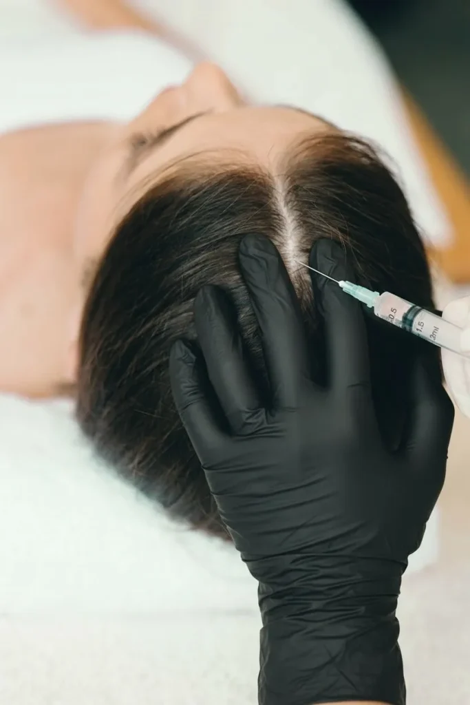 Hair restoration PRP near me in Edmonton